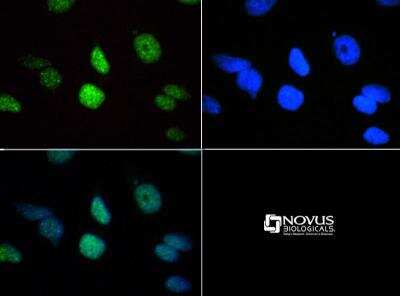 Immunocytochemistry/ Immunofluorescence: Histone H3 [Trimethyl Lys18] Antibody - BSA Free [NB21-1143]